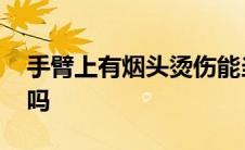 手臂上有烟头烫伤能当兵吗 烟头烫伤能当兵吗 